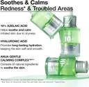 30-azelaic-acid-serum-for-rednes-anua-original-imahcsjpyp8aaqgh-1-1-1.jpeg